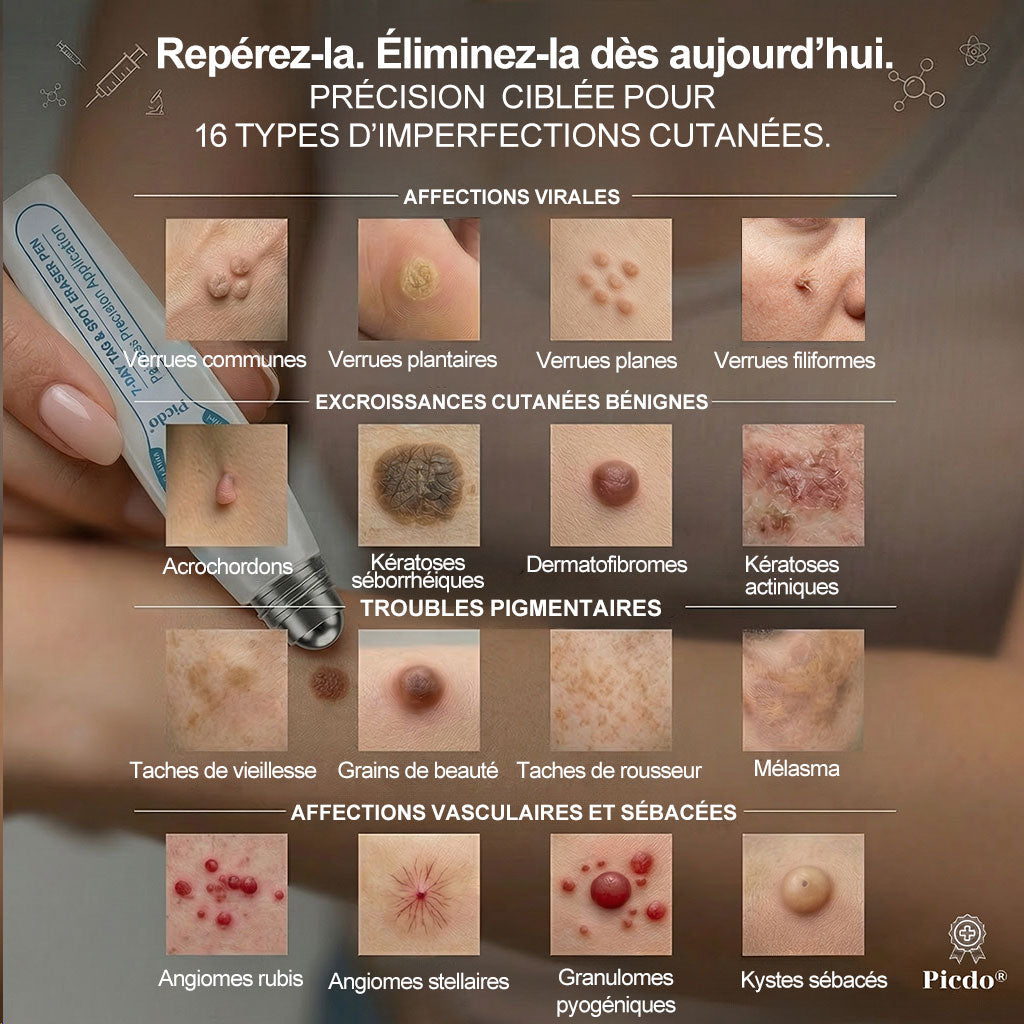 Boutique officielle de la marque |✅💎𝐏i𝐜𝐝o® 7 Jours Effaceur de taches et d’excroissances cutanées(Zéro douleur, zéro cicatrice – Roller)