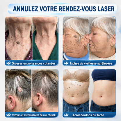𝐵o𝑢𝑡𝑖𝑞𝑢𝑒 O𝑓𝑓𝑖𝑐𝑖𝑒𝑙𝑙𝑒✅𝑵𝒆𝒌𝒊𝒔𝒔®💎𝑴𝒊𝐜𝐫𝐨𝒏𝐞𝐞𝒅𝒍𝒆𝒔 𝑷𝒆𝒂𝒖 𝑷𝒂𝒓𝒇𝒂𝒊𝒕𝒆 É𝒍𝒊𝒎𝒊𝒏𝒂𝒕𝒊𝒐𝒏 𝑫𝒆𝒔 𝑽𝒆𝒓𝒓𝒖𝒆𝒔 𝑷𝒂𝒕𝒄𝒉 (𝑃𝑜𝑢𝑟 𝑙𝑒𝑠 𝑎𝑐𝑟𝑜𝑐ℎ𝑜𝑟𝑑𝑜𝑛𝑠, 𝑙𝑒𝑠 𝑝𝑒𝑡𝑖𝑡𝑒𝑠 𝑒𝑥𝑐𝑟𝑜𝑖𝑠𝑠𝑎𝑛𝑐𝑒𝑠 𝑐𝑢𝑡𝑎𝑛é𝑒𝑠, 𝑙𝑒𝑠 𝑣𝑒𝑟𝑟𝑢𝑒𝑠, 𝑙𝑒𝑠 𝑔𝑟𝑎𝑖𝑛𝑠 𝑑𝑒 𝑏𝑒𝑎𝑢𝑡é, 𝑙𝑒𝑠 𝑡𝑎𝑐ℎ𝑒𝑠 𝑑𝑒 𝑣𝑖𝑒𝑖𝑙𝑙𝑒𝑠𝑠𝑒 𝑒𝑡 𝑙𝑒𝑠 𝑝𝑟𝑜𝑏𝑙è𝑚𝑒𝑠 𝑑𝑒 𝑝𝑖𝑔𝑚𝑒𝑛𝑡𝑎𝑡𝑖𝑜𝑛)