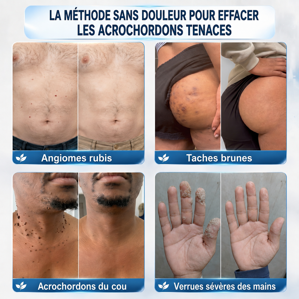 𝐵o𝑢𝑡𝑖𝑞𝑢𝑒 O𝑓𝑓𝑖𝑐𝑖𝑒𝑙𝑙𝑒✅𝑵𝒆𝒌𝒊𝒔𝒔®💎𝑴𝒊𝐜𝐫𝐨𝒏𝐞𝐞𝒅𝒍𝒆𝒔 𝑷𝒆𝒂𝒖 𝑷𝒂𝒓𝒇𝒂𝒊𝒕𝒆 É𝒍𝒊𝒎𝒊𝒏𝒂𝒕𝒊𝒐𝒏 𝑫𝒆𝒔 𝑽𝒆𝒓𝒓𝒖𝒆𝒔 𝑷𝒂𝒕𝒄𝒉 (𝑃𝑜𝑢𝑟 𝑙𝑒𝑠 𝑎𝑐𝑟𝑜𝑐ℎ𝑜𝑟𝑑𝑜𝑛𝑠, 𝑙𝑒𝑠 𝑝𝑒𝑡𝑖𝑡𝑒𝑠 𝑒𝑥𝑐𝑟𝑜𝑖𝑠𝑠𝑎𝑛𝑐𝑒𝑠 𝑐𝑢𝑡𝑎𝑛é𝑒𝑠, 𝑙𝑒𝑠 𝑣𝑒𝑟𝑟𝑢𝑒𝑠, 𝑙𝑒𝑠 𝑔𝑟𝑎𝑖𝑛𝑠 𝑑𝑒 𝑏𝑒𝑎𝑢𝑡é, 𝑙𝑒𝑠 𝑡𝑎𝑐ℎ𝑒𝑠 𝑑𝑒 𝑣𝑖𝑒𝑖𝑙𝑙𝑒𝑠𝑠𝑒 𝑒𝑡 𝑙𝑒𝑠 𝑝𝑟𝑜𝑏𝑙è𝑚𝑒𝑠 𝑑𝑒 𝑝𝑖𝑔𝑚𝑒𝑛𝑡𝑎𝑡𝑖𝑜𝑛)